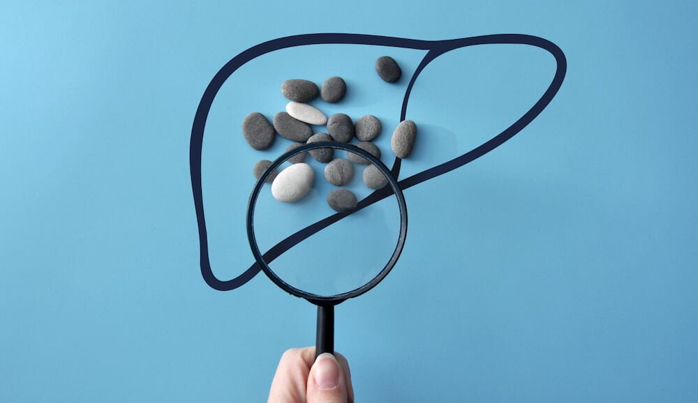 Как восстановить работу печени. Натуральные добавки и корректировка питания 4 Как восстановить работу печени