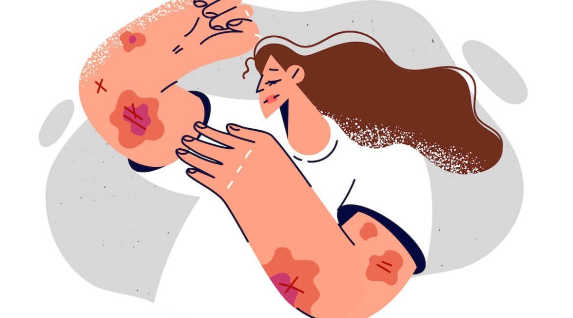 Противогрибковая программа Coral Club